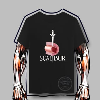 SCALIBUR - DISSECÇÃO ESPONTÂNEA DE ARTÉRIA CORONÁRIA 